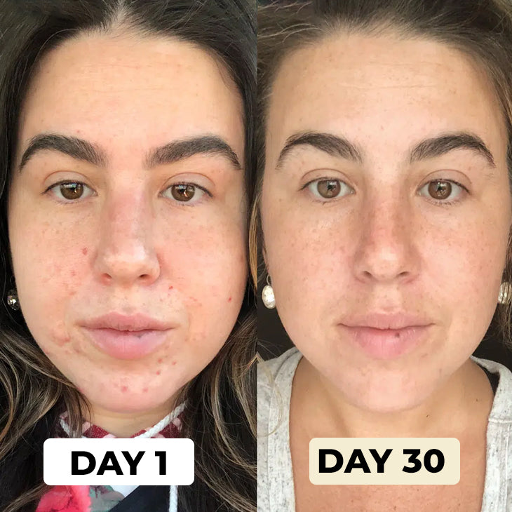 ShowerPRO™ - Better Skin, Hair & Increased Pressure