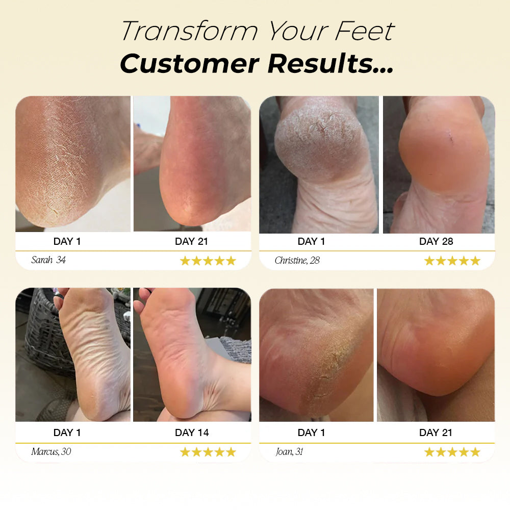 PediGlow™ - Get Smooth Feet In Minutes